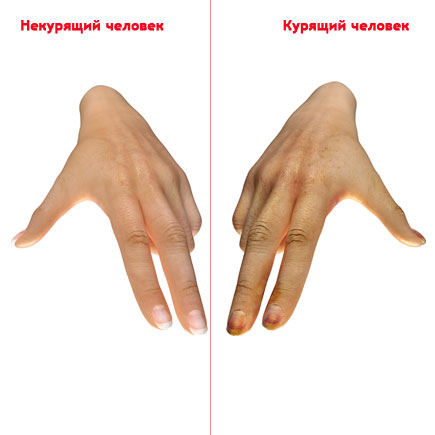 hand.jpg hand.jpg