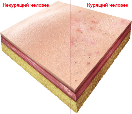 skin_m.jpg skin_m.jpg