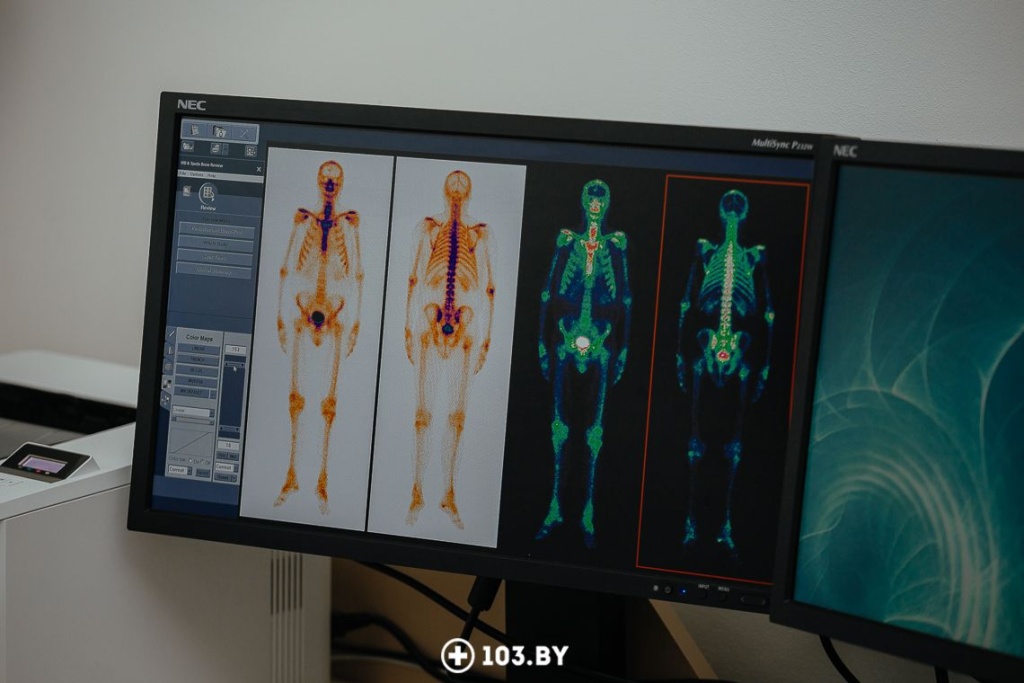 osteo1.jpg osteo1.jpg