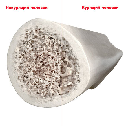 bones.jpg bones.jpg