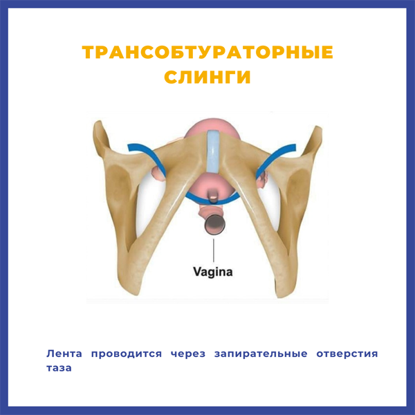 2.png 2.png