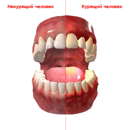 teeth.jpg teeth.jpg